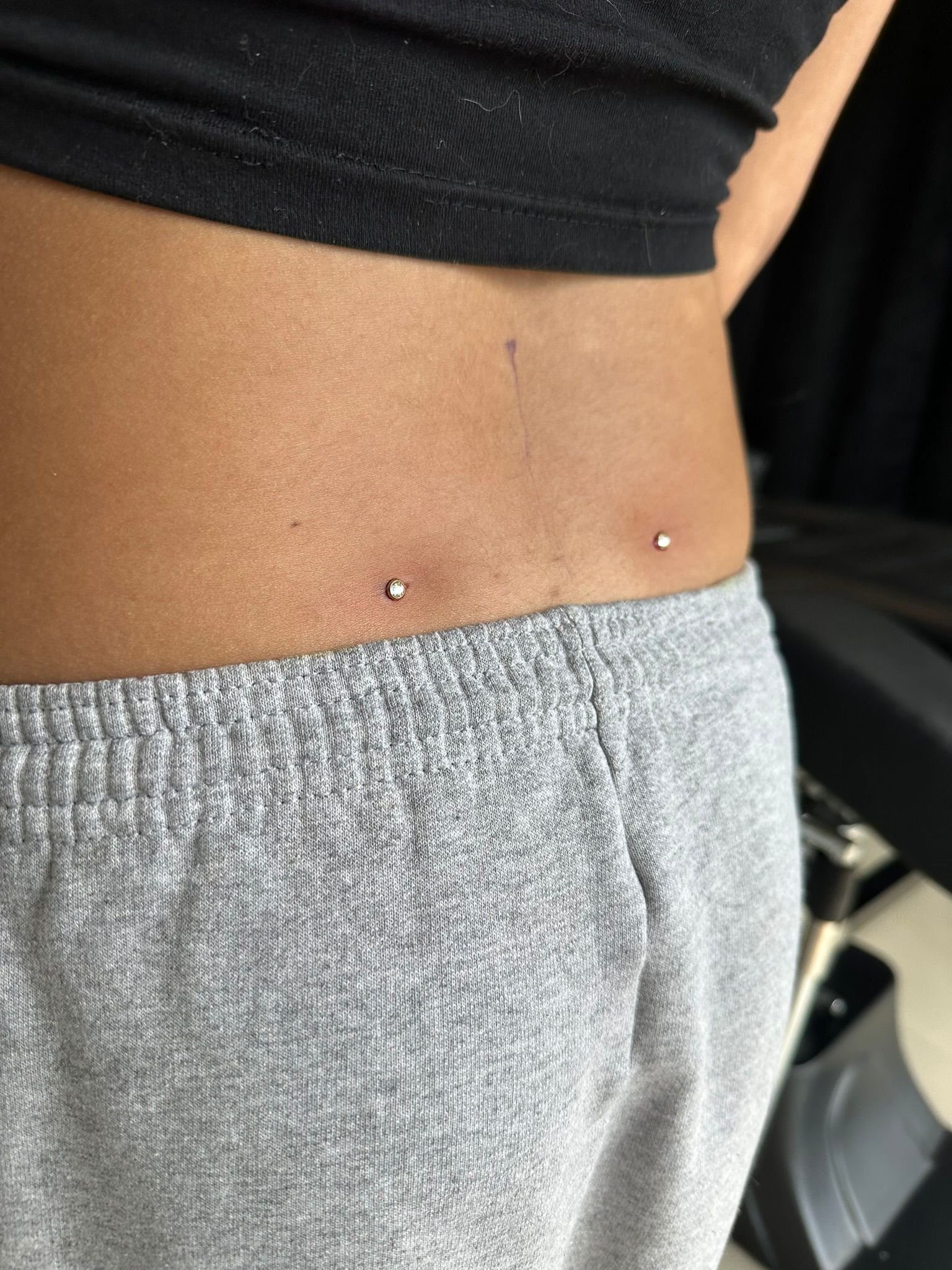 Microdermal